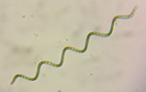 Foto de Espirulina